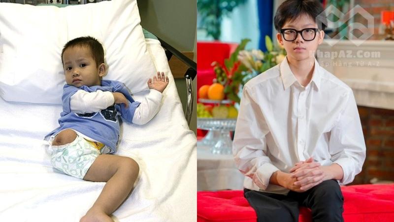 Chú lính chì Thiện Nhân: Hành trình từ bị bỏ rơi đến học bổng 85% tại VinUni Những cuộc phẫu thuật đau đớn và hành trình hồi sinh